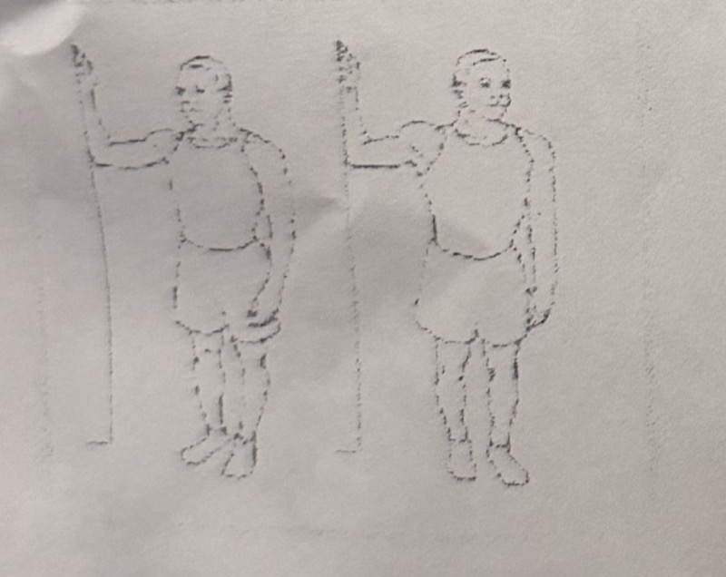 Pec Minor / Anterior Capsule Stretch illustration