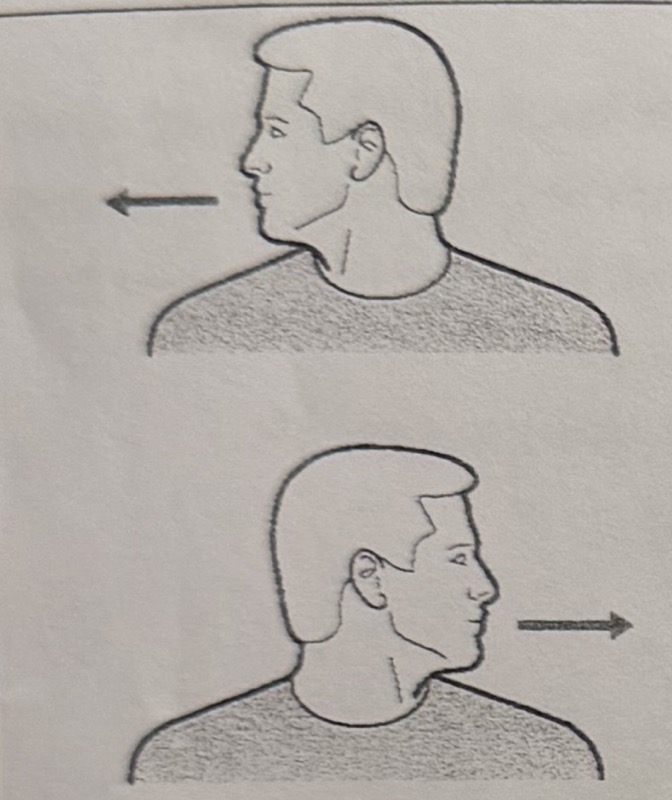 Rotation Stretch illustration